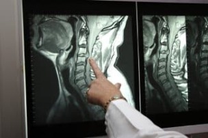 Röntgen vum Hals