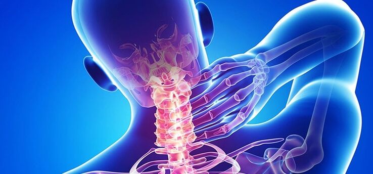 osteochondrosis vun der cervical Wirbelsail